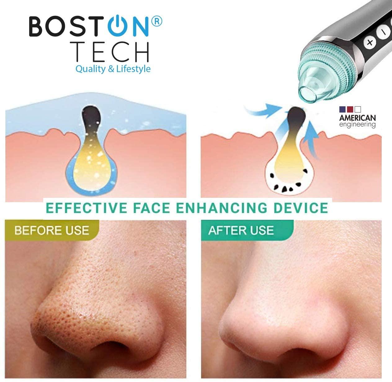 Removedor de puntos negros - BE107 - Bostontechstore